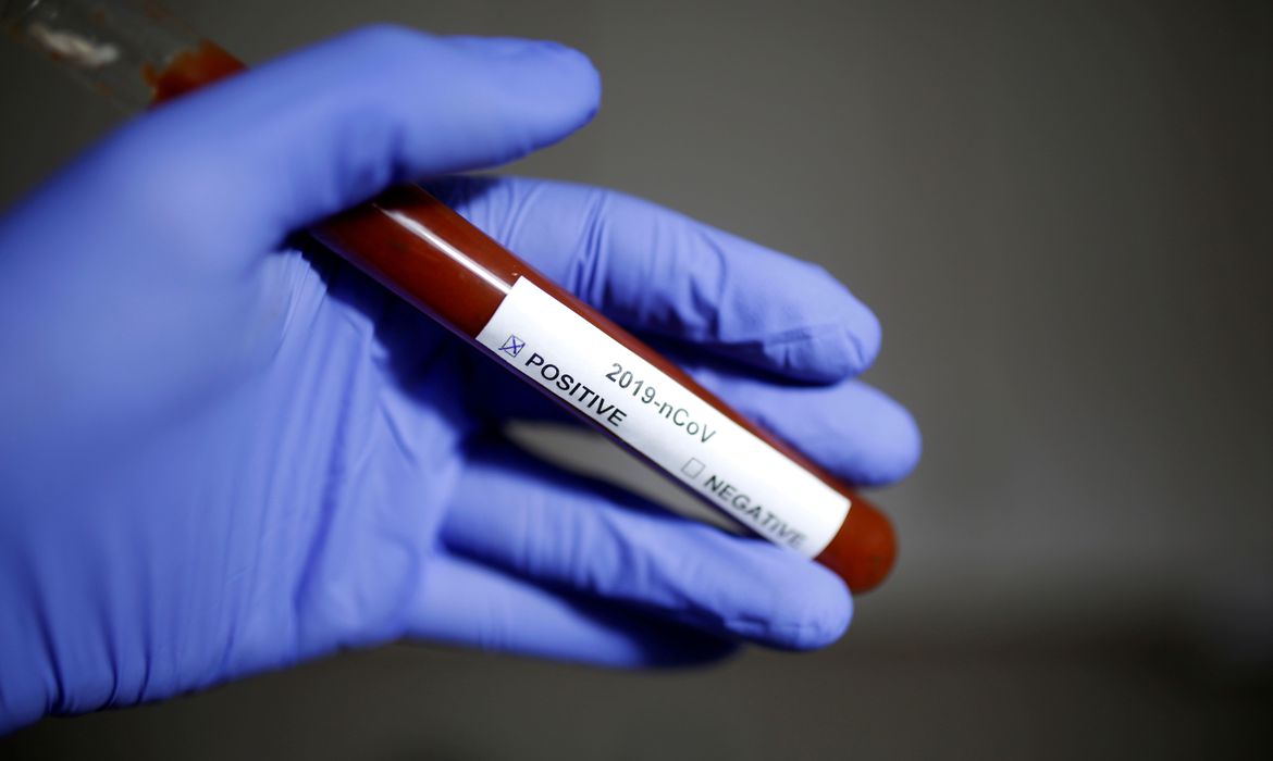 Ministério da Saúde coloca covid-19 como doença ocupacional, mas tira no dia seguinte. O que os especialistas acham?