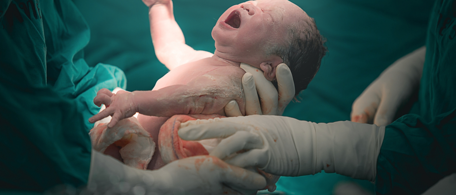 Justiça majora indenização em caso de erro médico que resultou em paralisia cerebral de bebê