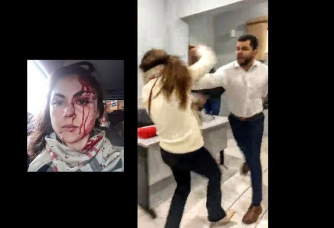 É POSSÍVEL EXCLUSÃO: Procurador que agrediu colega pode ser impedido de advogar e exercer a função pública, diz OAB