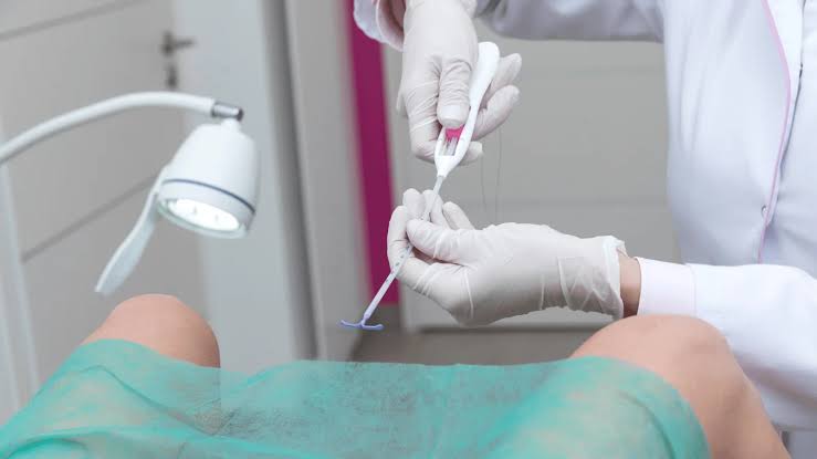 Justiça proíbe enfermeiros de inserirem DIU em pacientes por ser ato médico exclusivo