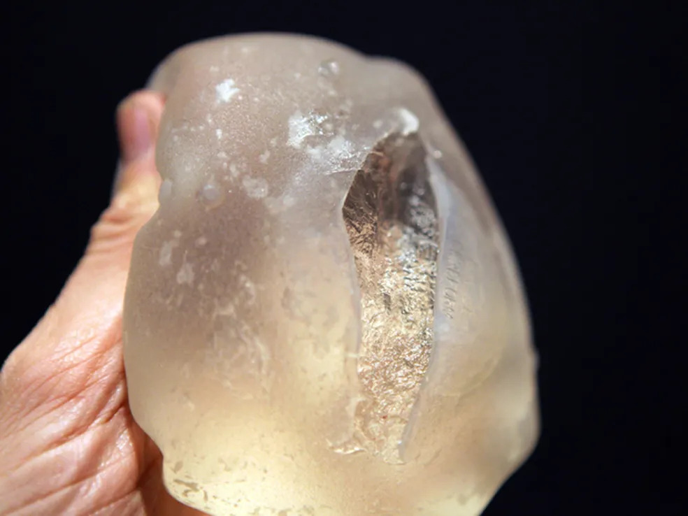 TJ-MG condena fabricante a indenizar paciente por rompimento de prótese mamária