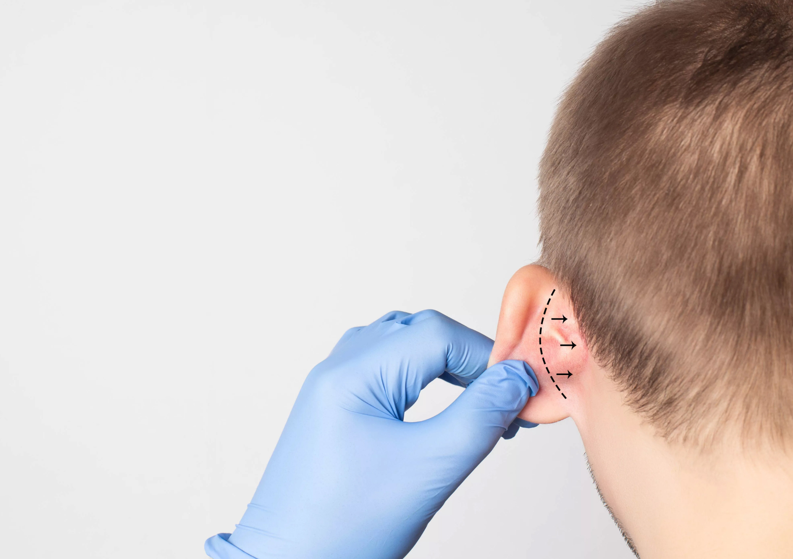 Justiça de Rondônia impede curso de otoplastia oferecido por profissional farmacêutico