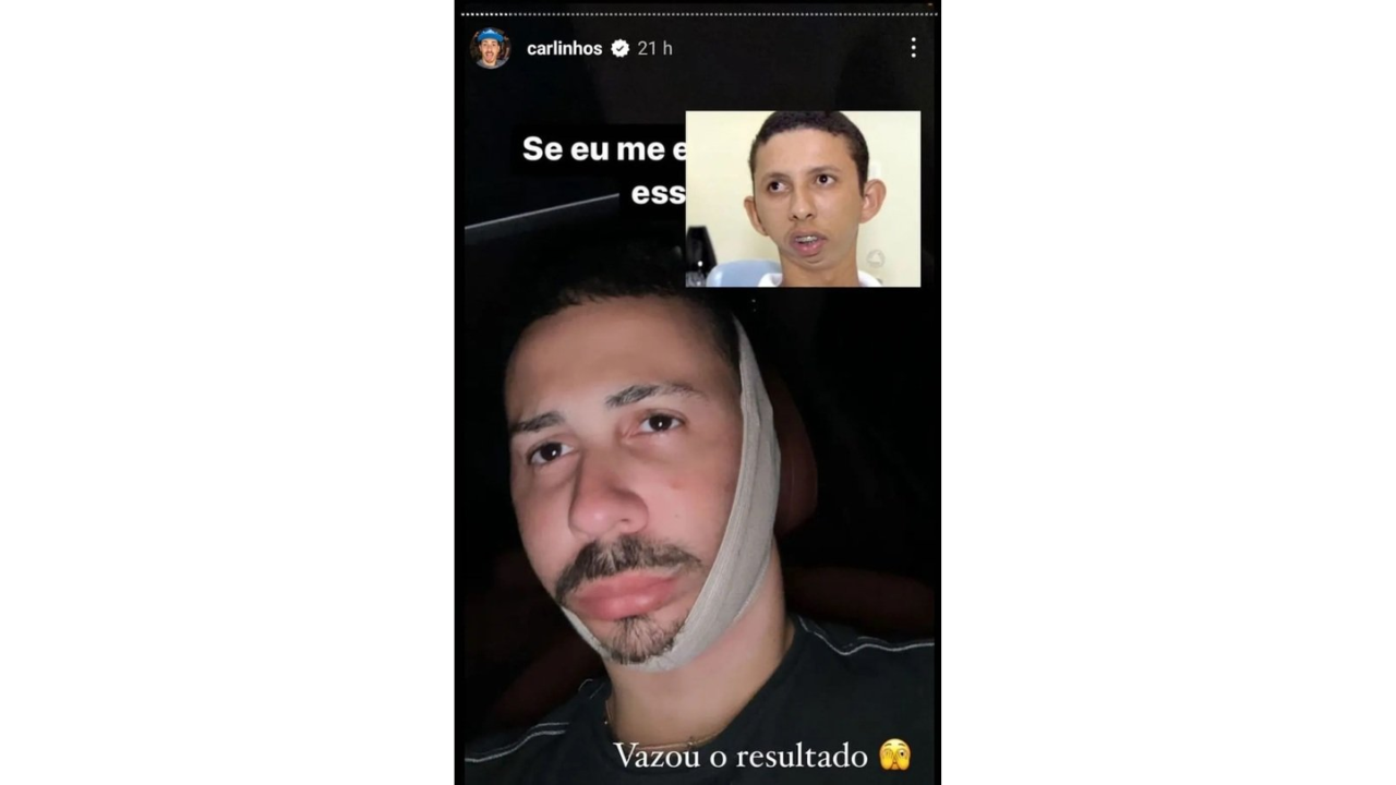 STJ condena Carlinhos Maia a pagar R$ 200 mil por piada com má formação óssea de homem do MT